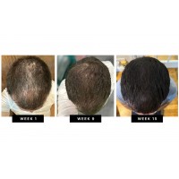 HUSSSH® Hair Recovery Shampoo for Reconstruction and Thickening